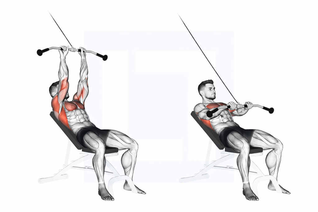 Cable Incline Pushdown